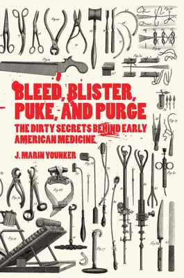 Krvácanie, pľuzgiere, zvracanie a očista: Vydajte sa na cestu do Ameriky a pite a pite. - Bleed, Blister, Puke, and Purge: The Dirty Secrets Behind Early American Medicine
