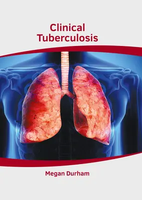 Klinická tuberkulóza - Clinical Tuberculosis