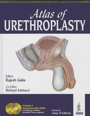 Atlas uretroplastiky - Atlas of Urethroplasty