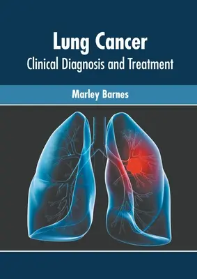 Rakovina pľúc: Klinická diagnostika a liečba - Lung Cancer: Clinical Diagnosis and Treatment