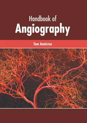 Príručka angiografie - Handbook of Angiography