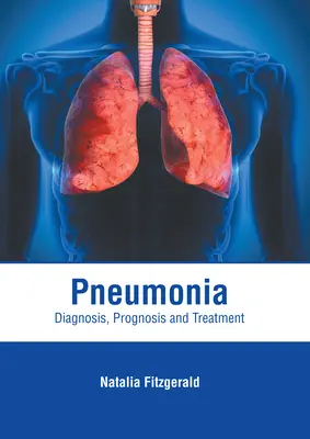Pneumónia: Diagnostika, prognóza a liečba - Pneumonia: Diagnosis, Prognosis and Treatment