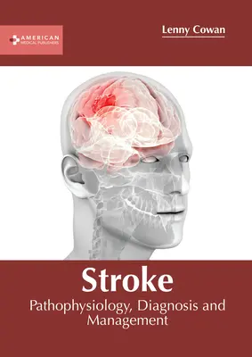 Cievna mozgová príhoda: Patofyziológia, diagnostika a liečba - Stroke: Pathophysiology, Diagnosis and Management
