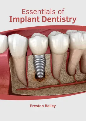 Základy implantologickej stomatológie - Essentials of Implant Dentistry