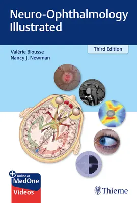 Neurooftalmológia s ilustráciami - Neuro-Ophthalmology Illustrated