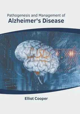 Patogenéza a liečba Alzheimerovej choroby - Pathogenesis and Management of Alzheimer's Disease