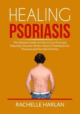 Liečenie psoriázy: Objavte všetky informácie o prírodnej liečbe psoriázy a psoriázy a naučte sa, ako ju prirodzene liečiť. - Healing Psoriasis: The Ultimate Guide on How to Cure Psoriasis Naturally, Discover All the Natural Treatments For Psoriasis and Psoriatic