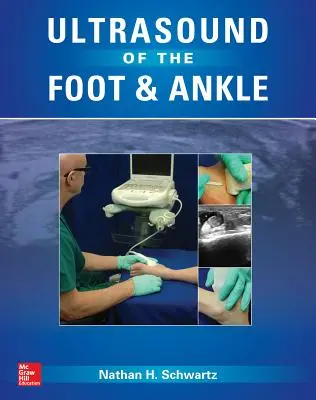 Ultrazvuk nohy a členka - Ultrasound of the Foot and Ankle