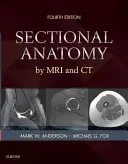 Prierezová anatómia pomocou MRI a CT - Sectional Anatomy by MRI and CT