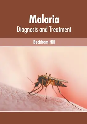 Malária: diagnostika a liečba - Malaria: Diagnosis and Treatment