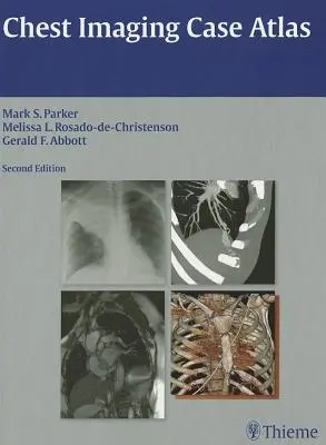 Atlas prípadov zobrazovania hrudníka - Chest Imaging Case Atlas