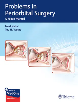 Problémy periorbitálnej chirurgie: Príručka na opravu - Problems in Periorbital Surgery: A Repair Manual