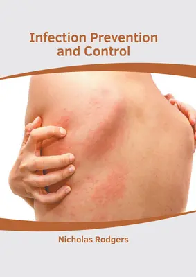 Prevencia a kontrola infekcií - Infection Prevention and Control