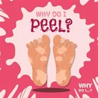 Prečo sa lúpem? - Why Do I Peel?