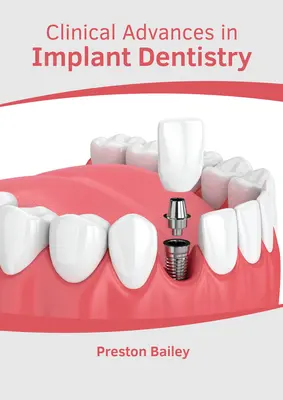 Klinické pokroky v implantologickej stomatológii - Clinical Advances in Implant Dentistry
