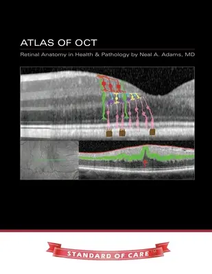 Atlas OCT: Anatómia sietnice v zdraví a patológii - Atlas of OCT: Retinal Anatomy in Health & Pathology