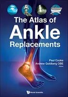 Atlas náhrad členka - The Atlas of Ankle Replacements
