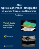 Atlas optickej koherentnej tomografie ochorení makuly a glaukómu - Atlas Optical Coherence Tomography of Macular Diseases and Glaucoma