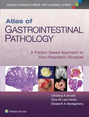 Atlas gastrointestinálnej patológie: A Pattern Based Approach to Non-Neoplastic Biopsies (Prístup k neeoplastickým biopsiám založený na vzoroch) - Atlas of Gastrointestinal Pathology: A Pattern Based Approach to Non-Neoplastic Biopsies