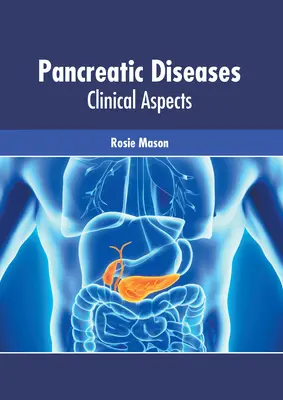 Choroby pankreasu: Klinické aspekty - Pancreatic Diseases: Clinical Aspects