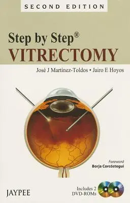 Krok za krokom: Vitrektómia [s 2 DVD] - Step by Step: Vitrectomy [With 2 Dvdroms]