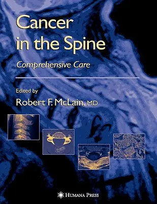 Rakovina v chrbtici: Komplexná starostlivosť - Cancer in the Spine: Comprehensive Care