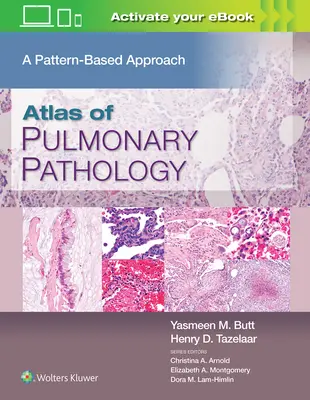 Atlas pľúcnej patológie: A Pattern Based Approach - Atlas of Pulmonary Pathology: A Pattern Based Approach