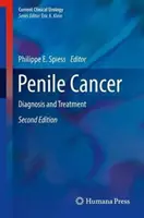 Rakovina penisu: Diagnostika a liečba - Penile Cancer: Diagnosis and Treatment