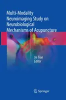 Multimodálna neurozobrazovacia štúdia neurobiologických mechanizmov akupunktúry - Multi-Modality Neuroimaging Study on Neurobiological Mechanisms of Acupuncture