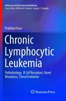 Chronická lymfocytárna leukémia: Patobiológia, receptory B-buniek, nové mutácie, klonálna evolúcia - Chronic Lymphocytic Leukemia: Pathobiology, B Cell Receptors, Novel Mutations, Clonal Evolution