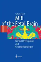 MRI mozgu plodu: Normálny vývoj a mozgové patológie - MRI of the Fetal Brain: Normal Development and Cerebral Pathologies