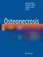 Osteonekróza - Osteonecrosis