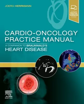 Praktická príručka kardioonkológie: A Companion to Braunwald's Heart Disease - Cardio-Oncology Practice Manual: A Companion to Braunwald's Heart Disease
