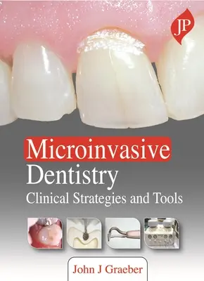 Mikroinvazívna stomatológia - klinické stratégie a nástroje - Microinvasive Dentistry - Clinical Strategies and Tools