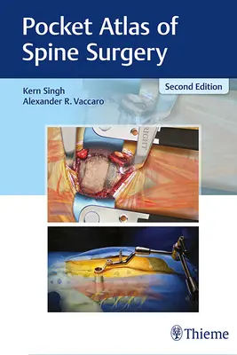 Vreckový atlas chirurgie chrbtice - Pocket Atlas of Spine Surgery