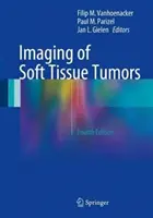 Zobrazovanie nádorov mäkkých tkanív - Imaging of Soft Tissue Tumors