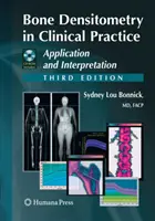 Kostná denzitometria v klinickej praxi: Aplikácia a interpretácia - Bone Densitometry in Clinical Practice: Application and Interpretation