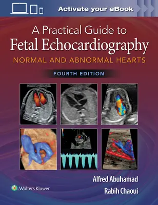 Praktický sprievodca fetálnou echokardiografiou: Normálne a abnormálne srdcia - A Practical Guide to Fetal Echocardiography: Normal and Abnormal Hearts