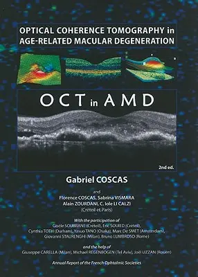 Optická koherentná tomografia pri vekom podmienenej degenerácii makuly - Optical Coherence Tomography in Age-Related Macular Degeneration