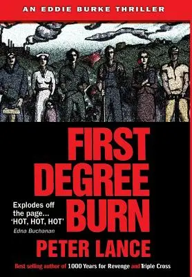 Popáleniny prvého stupňa - First Degree Burn