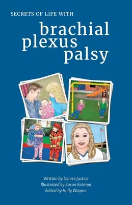 Tajomstvá života s obrnou ramenného pletenca - Secrets of Life with Brachial Plexus Palsy