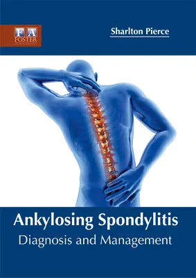 Ankylozujúca spondylitída: Diagnostika a liečba - Ankylosing Spondylitis: Diagnosis and Management