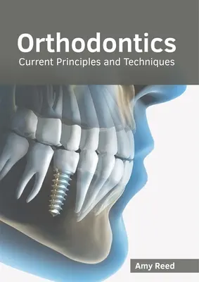 Ortodoncia: Súčasné princípy a techniky - Orthodontics: Current Principles and Techniques