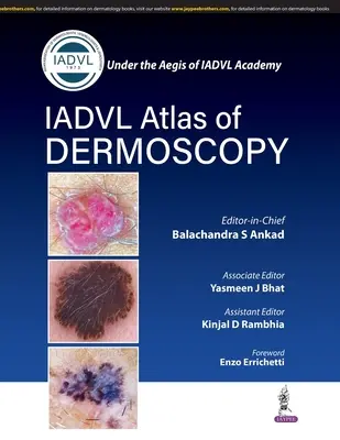Atlas dermoskopie - Atlas of Dermoscopy