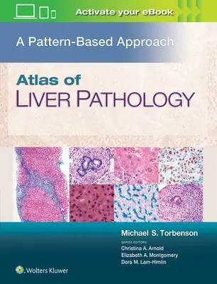 Atlas patológie pečene: A Pattern-Based Approach (Prístup založený na vzoroch) - Atlas of Liver Pathology: A Pattern-Based Approach