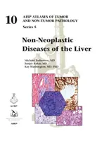 Neneoplastické ochorenia pečene - Non-Neoplastic Diseases of the Liver