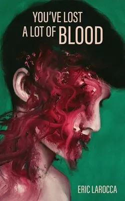 Stratil si veľa krvi - You've Lost a Lot of Blood