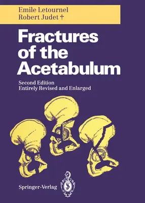 Zlomeniny kostrče - Fractures of the Acetabulum