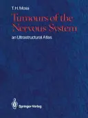 Nádory nervového systému: Ultraštrukturálny atlas - Tumours of the Nervous System: An Ultrastructural Atlas