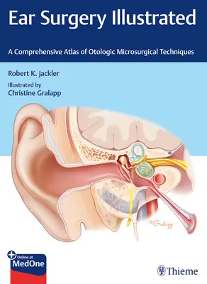 Ilustrovaná chirurgia ucha: Komplexný atlas otologických mikrochirurgických techník - Ear Surgery Illustrated: A Comprehensive Atlas of Otologic Microsurgical Techniques
